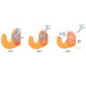 Kit riparazione attuatore di ricambio gancio rapido per trattore cat. 3 - 3S CBM